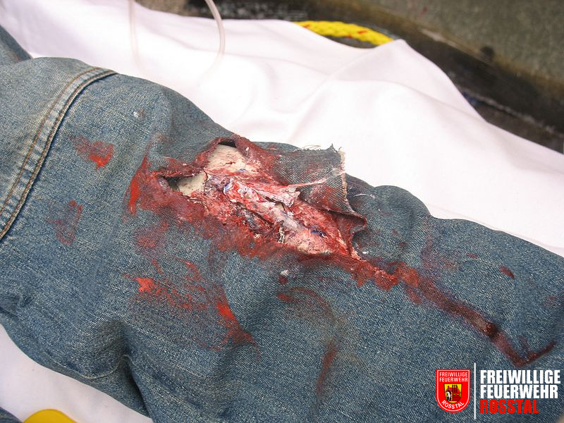 Bild 14 von 30 Realit&auml;tsnahe Wunde